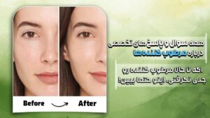 سوال و جواب ها راجع به کرم های مرطوب کننده