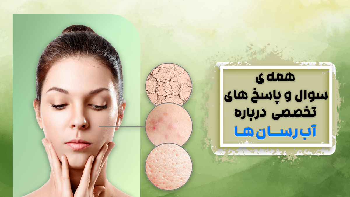 سوالات تخصصی راجع به استفاده از آبرسان ها