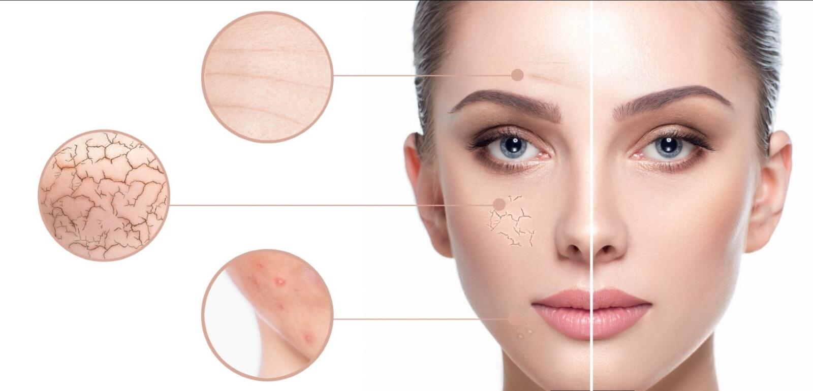اهمیت ژل شستشو صورت در سلامت پوست