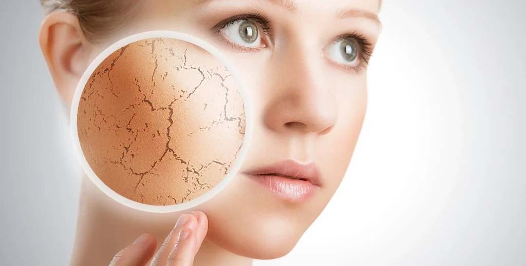 چرا پوست خشک و حساس نیاز بیشتری به ضد آفتاب داره؟
