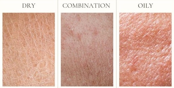 مرحله اول در انتخاب کرم مرطوب کننده: شناخت انواع پوست
