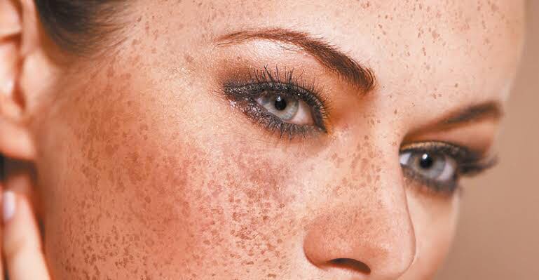 مرحله ششم: توجه به مشکلات خاص پوستی